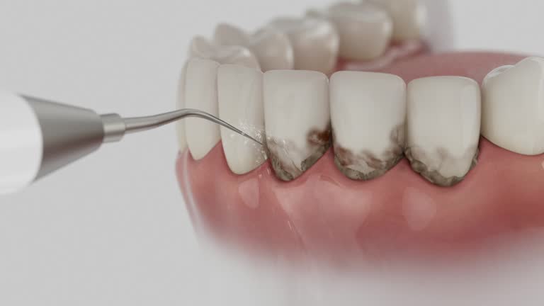 Reliable Dental Implants contractor in Artesia, NM by Smile Center Dentistry